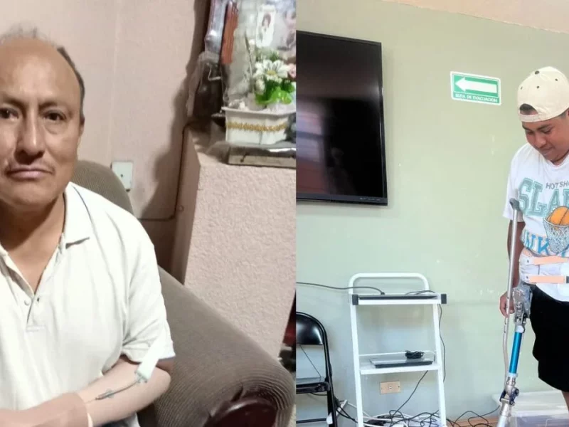 Diego y Don Ranulfo reciben sus primeras prótesis tras gestión de Shamy Spezia