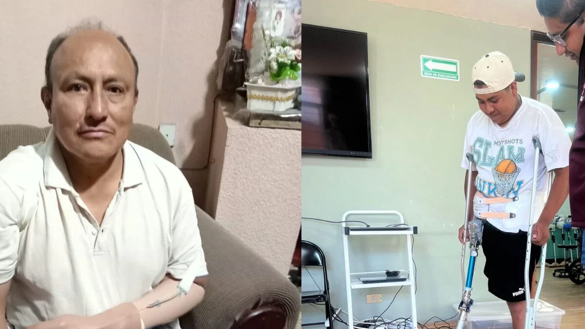 Diego y Don Ranulfo reciben sus primeras prótesis tras gestión de Shamy Spezia